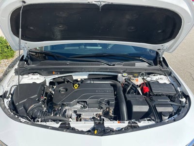 2025 Chevrolet Malibu 1LT